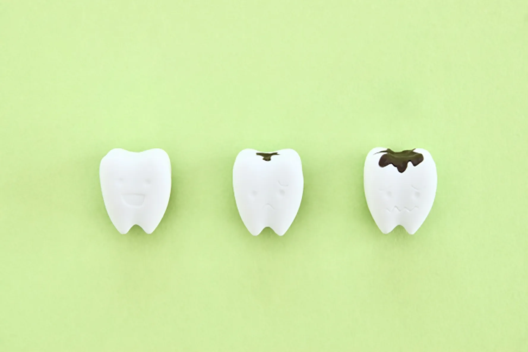 ブリッジ寿命を縮める要因