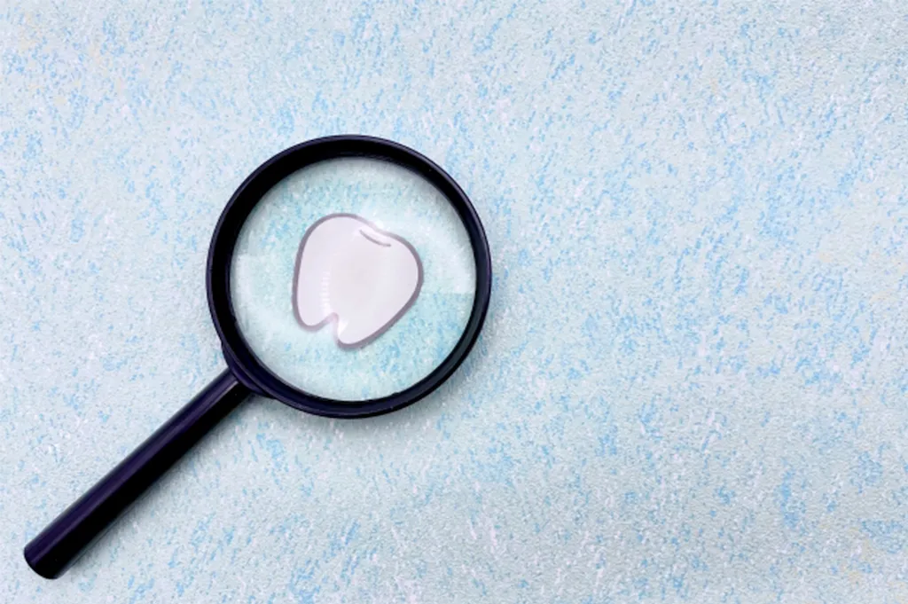 オールオン4メンテナンス