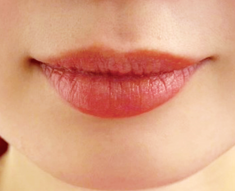 症例のアフター画像