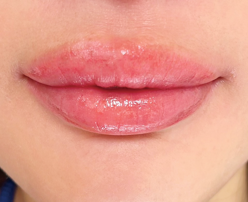 症例のアフター画像