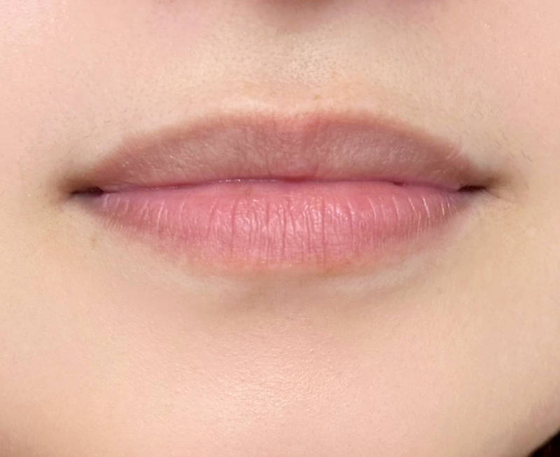 症例のビフォー画像