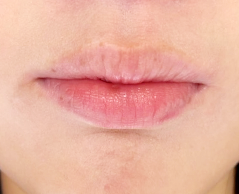 症例のビフォー画像