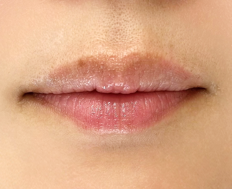 症例のビフォー画像