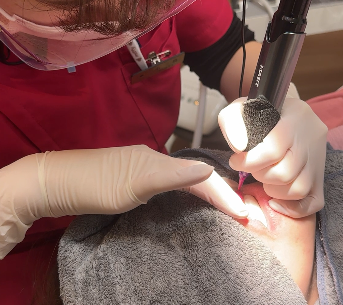 歯科衛生士の施術中の写真